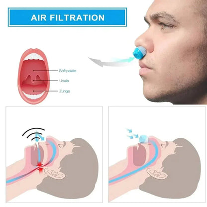 Mikro-CPAP-Schlafapnoe-Gerät für Reisen und gegen Schnarchen – CPAP-Alternative
